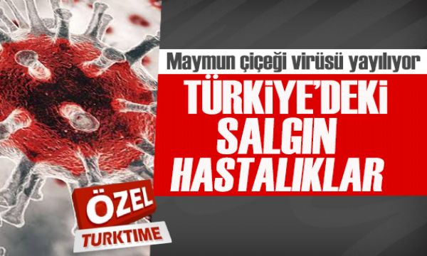 Maymun çiçeği virüsü yayılıyor! Peki Türkiye'de hangi salgın hastalıklar görüldü?