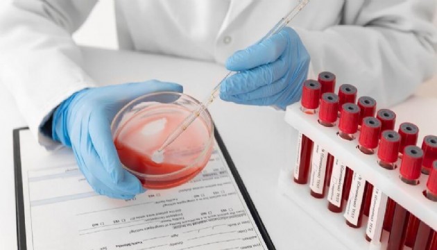 Çarpıcı araştırma: A Rh+ kan grubuna sahip olanları ilgilendiriyor