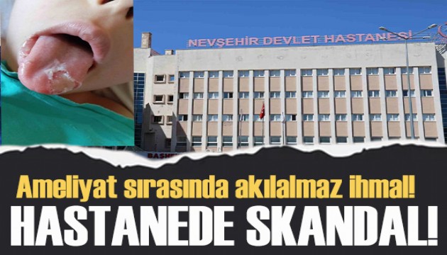 Akılalmaz olay! 5 yaşındaki çocuğun ameliyatta dili ve dudağı yandı