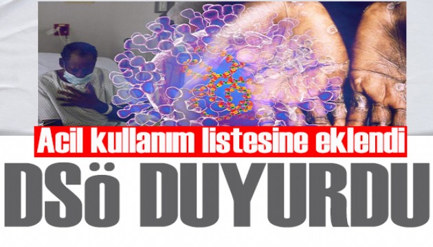 DSÖ, Maymun Çiçeği aşısına acil kullanım onayı verdi