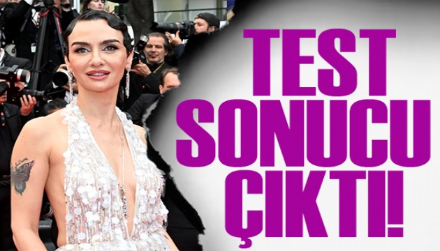 Birce Akalay uyuşturucu test sonucunu maç sırasında öğrendi!