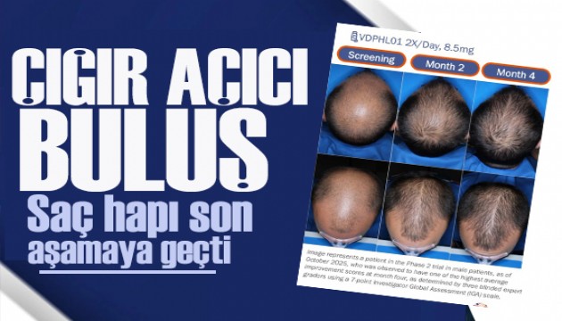 Kelliğe karşı 30 yıl sonra gelen çığır açıcı buluş!