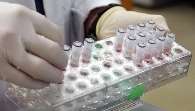 HIV tedavisinde çığır açacak adım: Virüs hücre içinde görünür hale getirildi