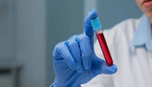 O kan grubuna sahip olanlara koltuktan kalkmak bile zor geliyor!