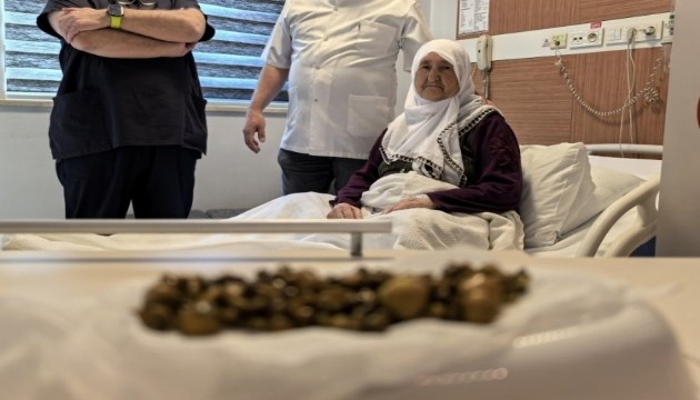 Yaşlı kadının safra kesesinden 213 adet taş çıktı!