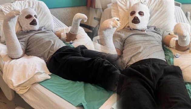 Çay demlemek isterken canından oluyordu!