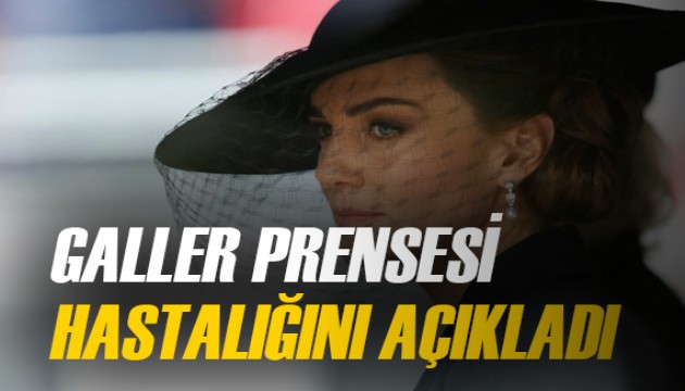 Galler Prensesi Kate hastalığını açıkladı