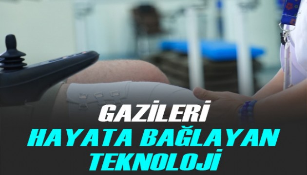 Gaziler son teknolojiyle üretilen protezlerle hayatın içinde kalıyor