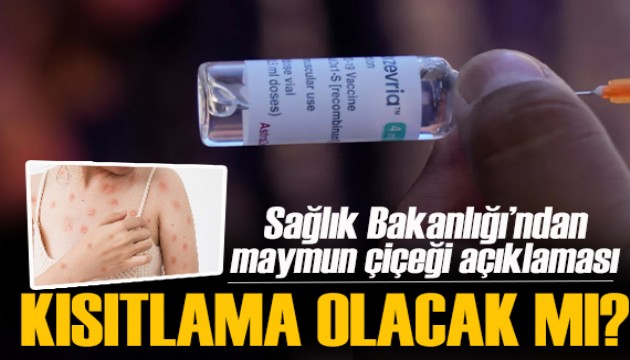 Son dakika / Sağlık Bakanlığı'ndan maymun çiçeği açıklaması