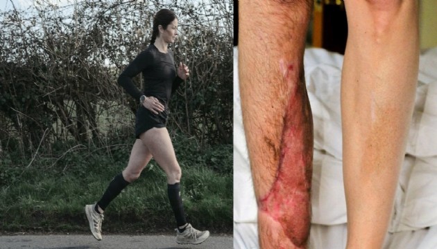 Hayatta kalamaz demişlerdi, şampiyon oldu