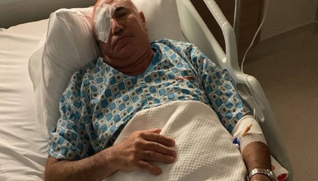 Mahmut Tanal, polis müdahalesinde gözünden yaralandı