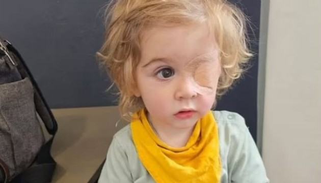 Masum bir öpücük küçük çocuğu kör etti