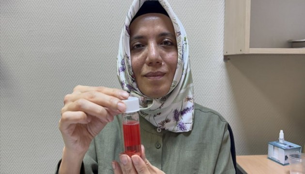 SDÜ Göz bankası: 100'den fazla kornea nakli