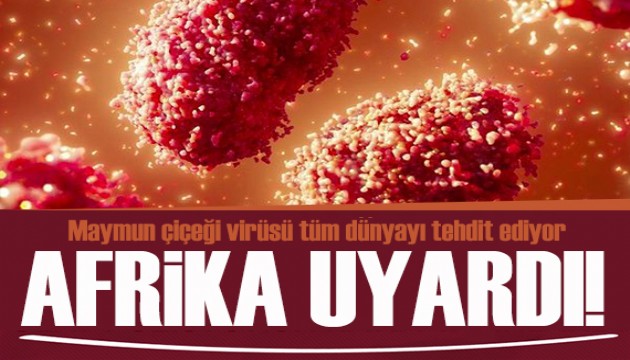 Afrika uyardı: M Çiçeği Virüsü tüm dünyayı tehdit ediyor