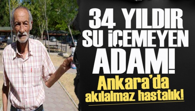Ankara'da 34 yıldır su içemeyen yaşlı adam, 10 gündür yemek de yiyemiyor