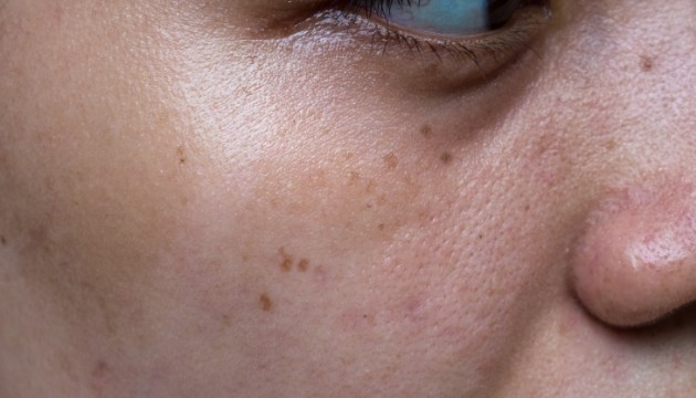 Otururken yüzde oluşan bu belirti kanser habercisi olabilir!