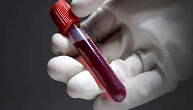 Dünya Tıp literatürüne yeni bir kan grubu girdi: 'Gwada Negatif'