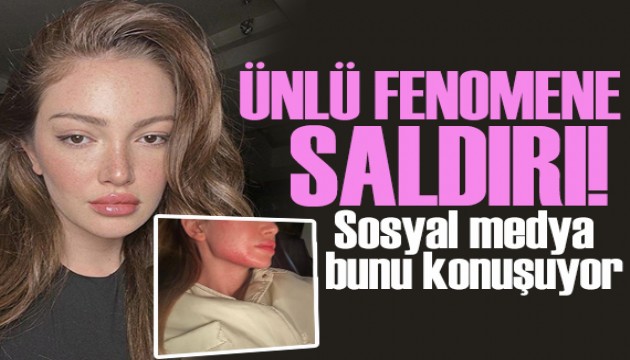 Şiddet iddialarıyla gündeme geldi! Danla Bilic'e saldırı!