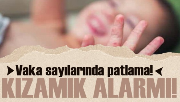 Vaka sayılarında patlama! Avrupa'da kızamık ve boğmaca alarmı
