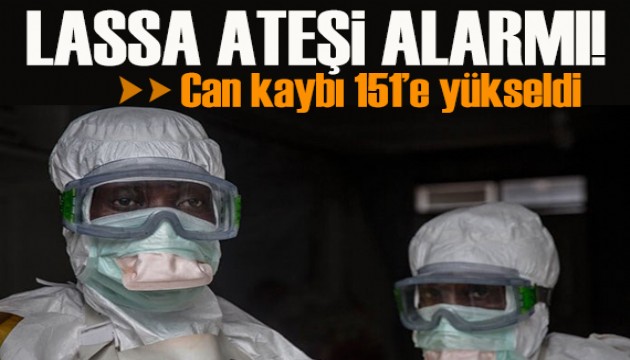 Lassa ateşi alarmı: Can kaybı 151'e yükseldi