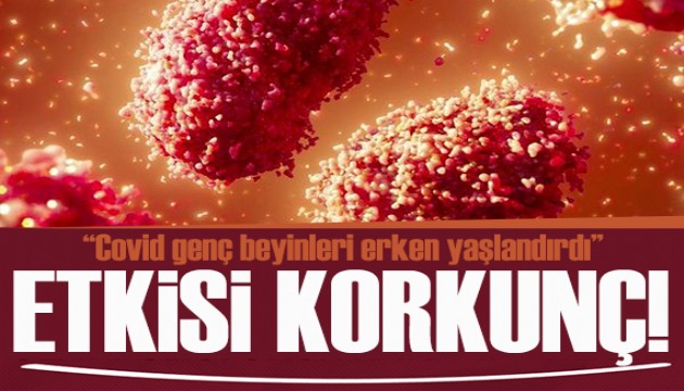 Covid'in beyin üzerindeki korkunç etkisi ortaya çıktı