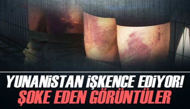 Yunanistan işkence ediyor! Şoke eden görüntüler