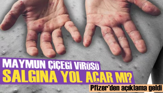 Maymun çiçeği salgına yol açar mı? Pfizer açıkladı