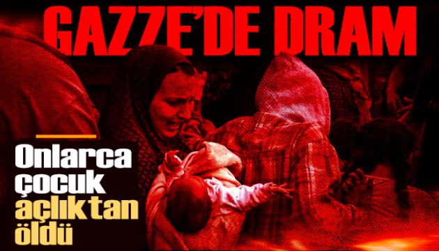 Gazze'de insanlık dramı! Onlarca çocuk açlıktan öldü
