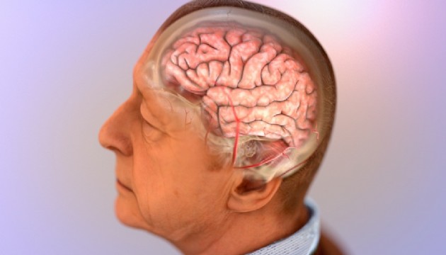 Bilim insanlarından Alzheimer ile mücadele formülü