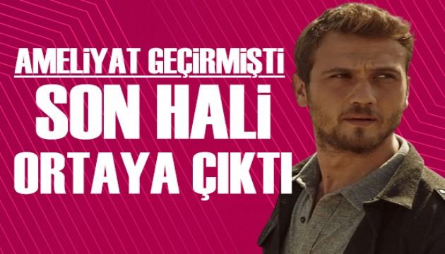 Ameliyat geçiren Aras Bulut İynemli'nin son hali ortaya çıktı