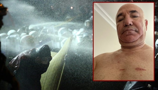 CHP'li Tanal'a şiddet: Bu yaralar hukuk devletinde açılmıştır