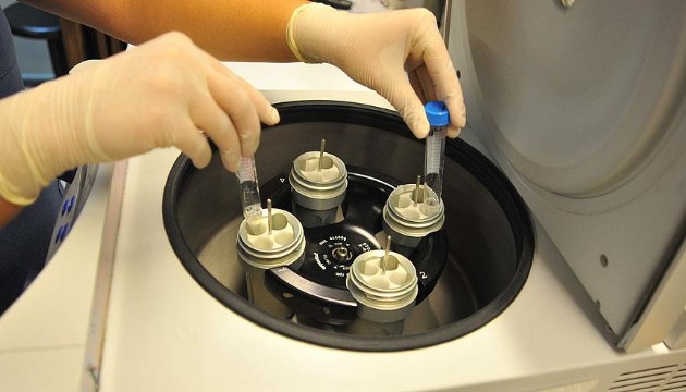 SGK hangi şartlarda tüp bebek tedavisini destekliyor?