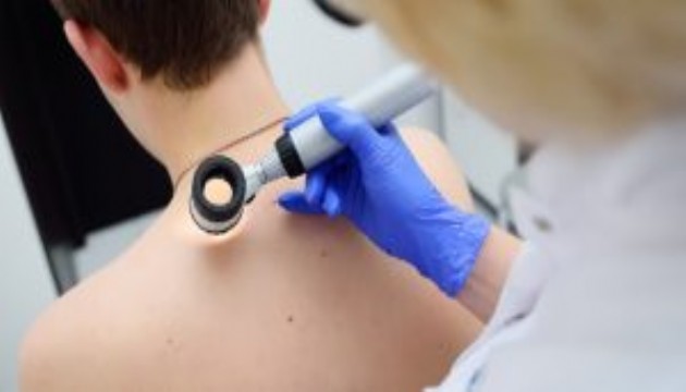 Uzmanlardan cilt kanseri uyarısı