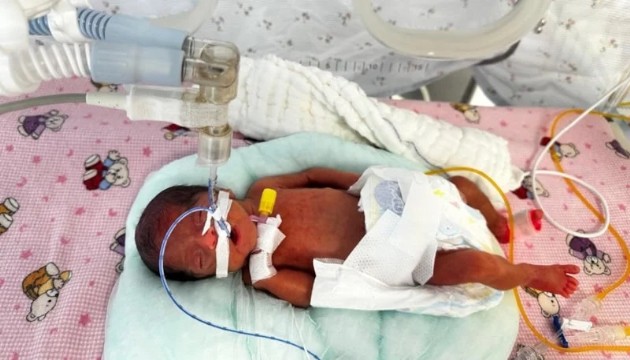 650 gram doğan mucize bebek