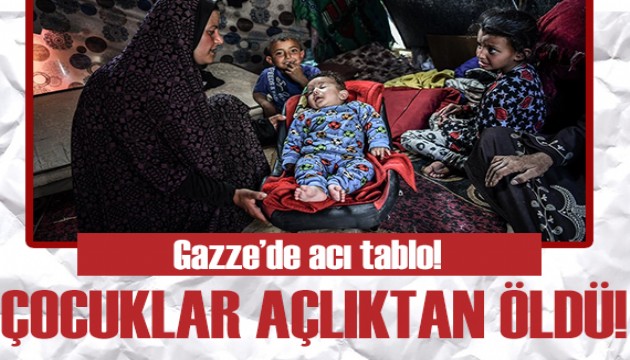 Acı tablo: Gazze'de 15 çocuk açlıktan öldü!