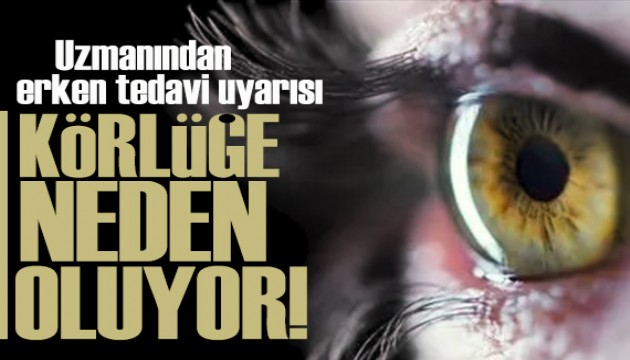 Uzmanı uyardı: Erken tedavi edilmezse körlüğe neden oluyor