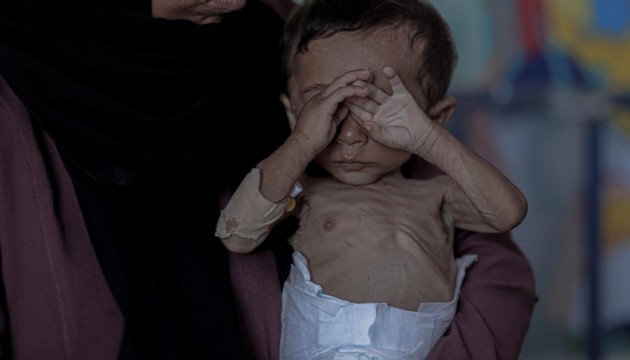 24 saatte 11 kişi daha açlıktan hayatını kaybetti