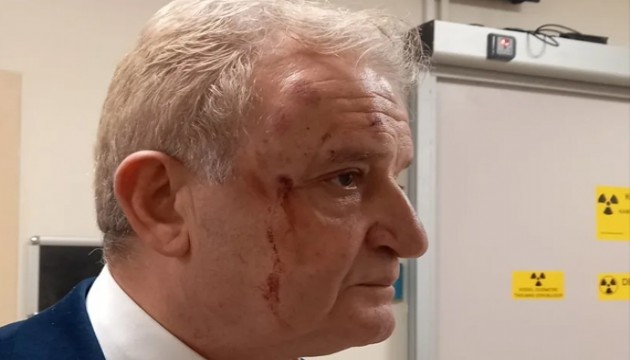 Gazeteciye yumruklu saldırı