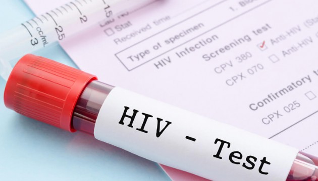 HIV tedavisinde devrim niteliğinde yöntem!