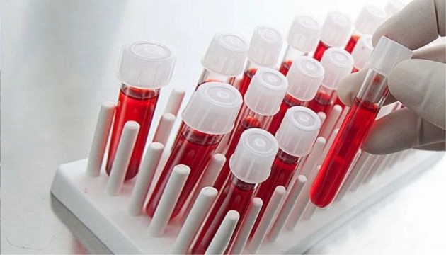 Felç riskinin en yüksek olduğu kan grubu açıklandı