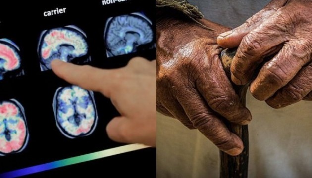 Çarpıcı araştırma: Beyin hangi yaşta yaşlanmaya başlıyor?