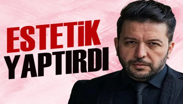 Nihat Doğan estetik yaptırdı: Sosyal medyada gündem oldu