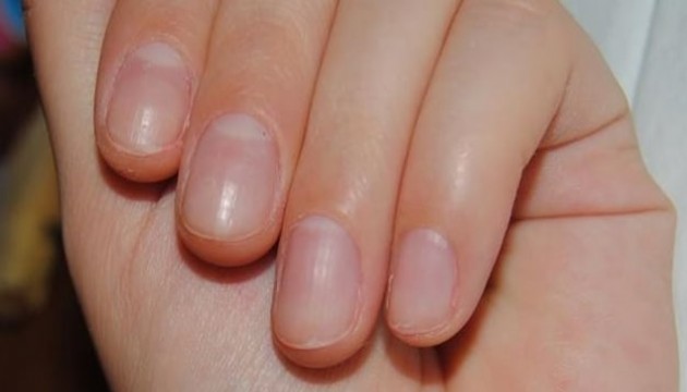 Tırnaklarını keserken kimse dikkat etmiyor! Doktorlar uyardı