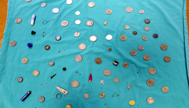 Para, toka, çivi... Hepsi mideden çıktı!