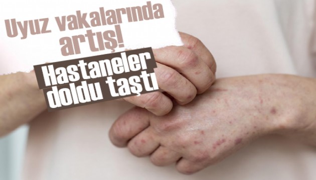 Uyuz vakalarında yeniden artış: Hastaneler doldu taştı