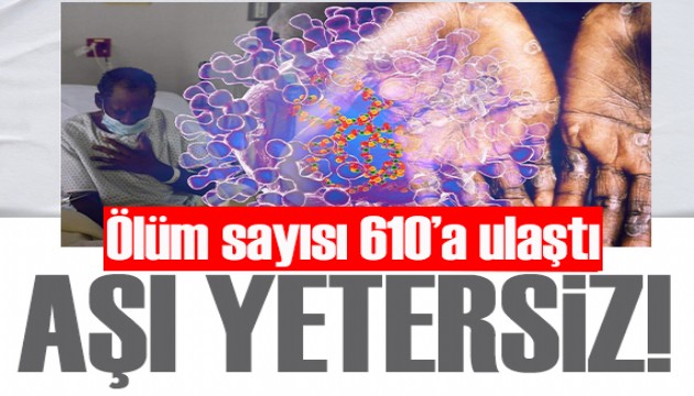 'Maymun çiçeğinde aşı yetersiz': Ölenlerin sayısı 610'a yükseldi