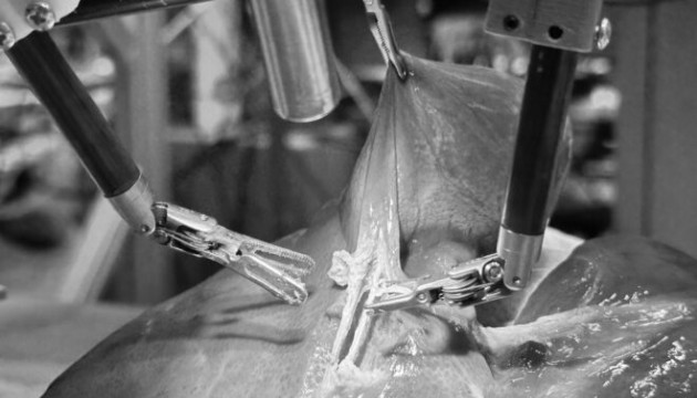 Robot cerrah sıfır hata ile ameliyat yaptı