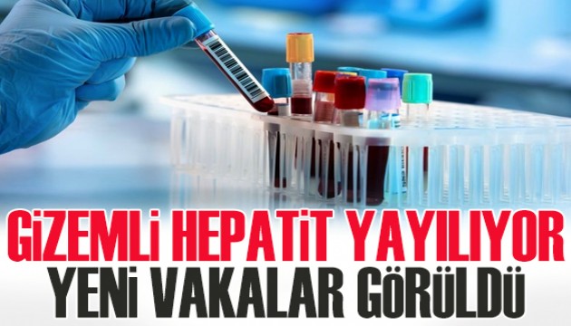 Gizemli hepatit yayılıyor: Yeni vakalar görüldü