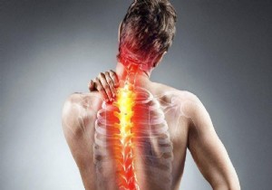 Dikkat! Skolyoz, buluğ çağında ilerleyebilir