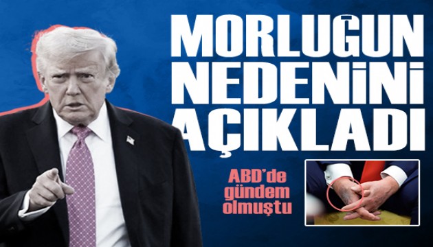 Trump'tan sağlık iddialarına yanıt: Elindeki morluğun nedenini ilk kez açıkladı